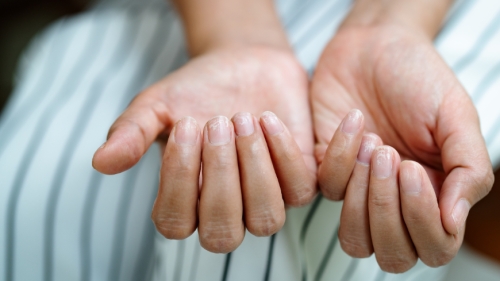 How to Prevent Dry & Brittle Nails in Canada’s Harsh Winter