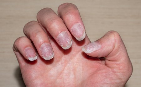 Nail Care in Humid Weather: Tips to Prevent Lifting & Cracking