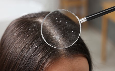 Summer Scalp Care Tips: How to Beat the Heat and Keep Hair Healthy