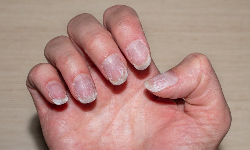 Nail Care in Humid Weather: Tips to Prevent Lifting & Cracking